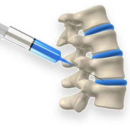 Top-Rated Spine Surgeon in Southern California | Hamid Mir M.D.